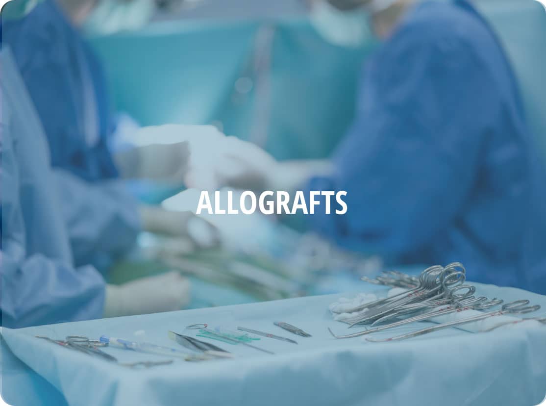 Allografts